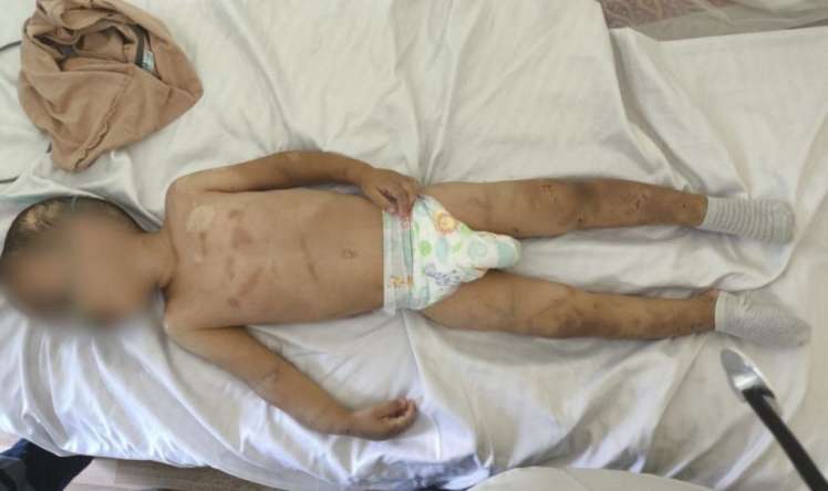 Ağdamda ata 2 yaşlı uşağını ölümcül döydü -  FOTO