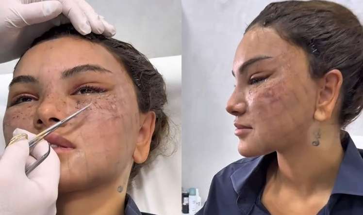 Estetik prosedurlardan sonra üzü tanınmaz hala düşdü -  VİDEO