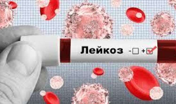 Qan xərçəngindən kimlər daha çox    əziyyət çəkir?