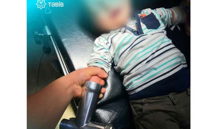 2 yaşlı uşağın qolu ətçəkəndə qaldı  - Foto