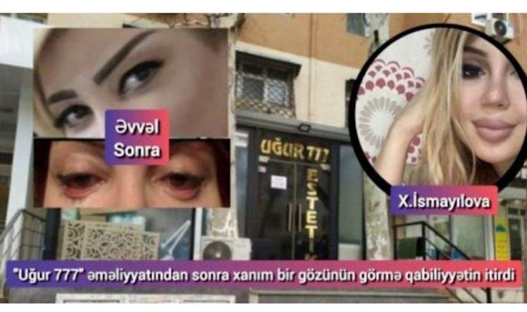 Daha bir saxta estetik həkim ifşa olundu 