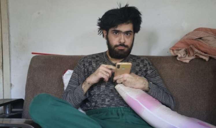 Üç ildir evdən çölə çıxmayan gənc hər kəsi şoka saldı -  FOTO 