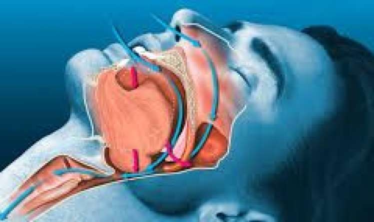  Tibdə ilk  - Xorultu xərçəng riski ilə əlaqələndirildi