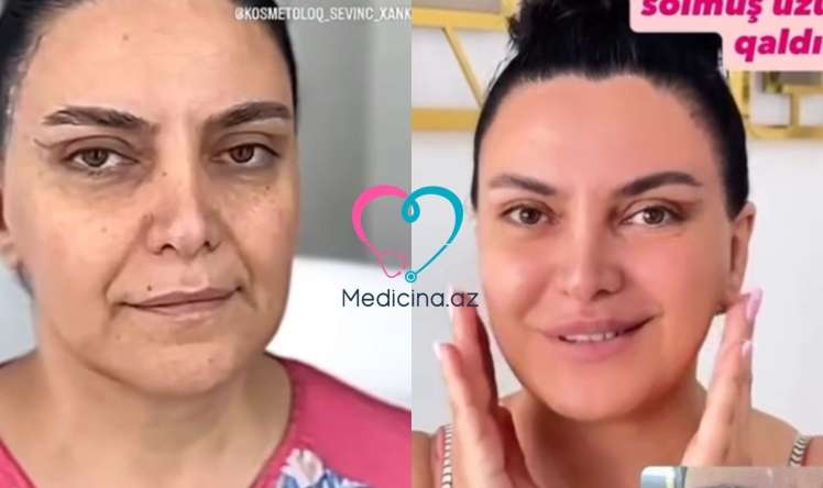 Bakıda qadının dəyişimi hamını şoka saldı -  VİDEO