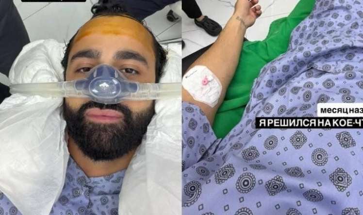 Hüseyn saç əkdirdi -  FOTO