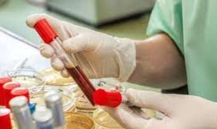  Hemoqlobinin səviyyəsini normalda necə saxlayaq?  