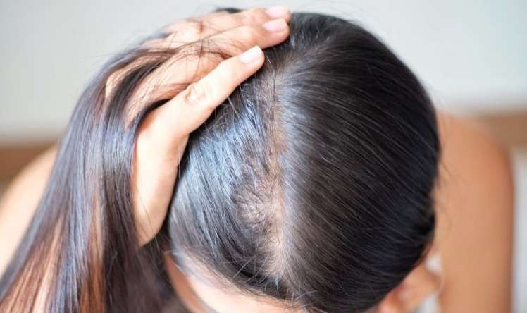 Qışda saç tökülməsi arta bilər -  Mütəxəssisdən xəbərdarlıq