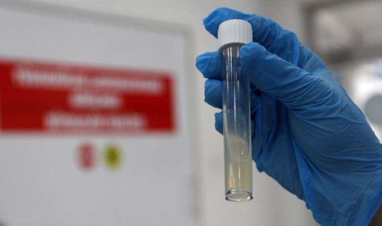 Dünyanın ən ölümcül yoluxucu xəstəliyi -  ÜST-ün dəhşətli statistikası