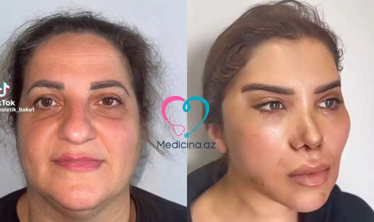 60 yaşlı qadının dəyişimi müzakirələrə səbəb oldu -  VİDEO