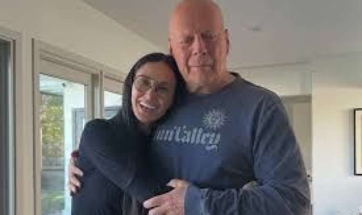  Məşhur aktyorun beyni elm üçün    - bağışlanıldı