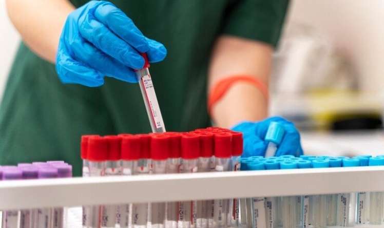 Bu ucuz analizi hamı versin, xərçəng riskini göstərir -  Kardioloqdan