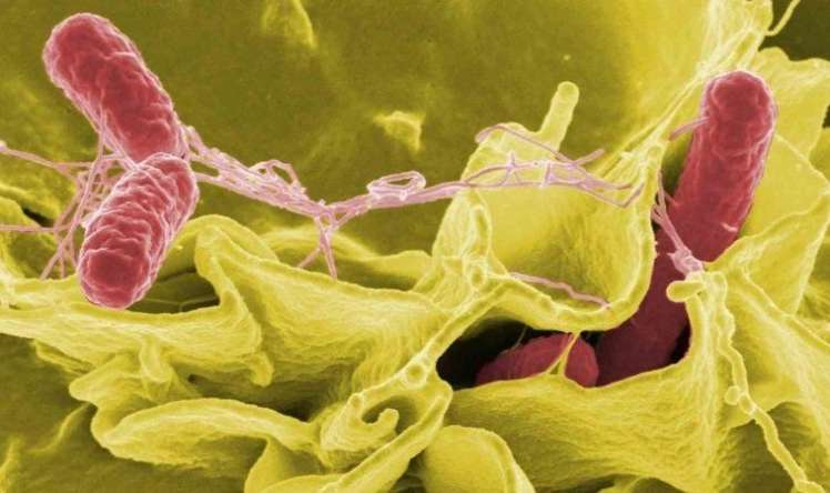 Salmonellanı necə tanımaq olar? -  Bu simptomlar varsa...