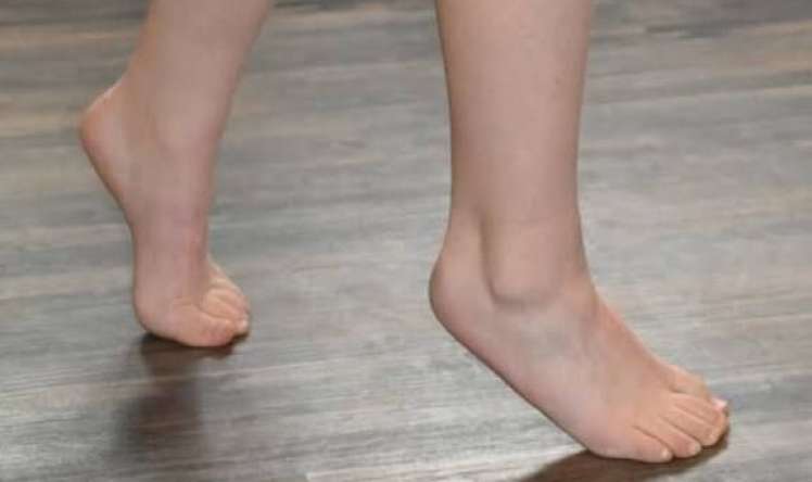 Uşaqların barmaq ucunda gəzməməai üçün bunları edin -  VİDEO