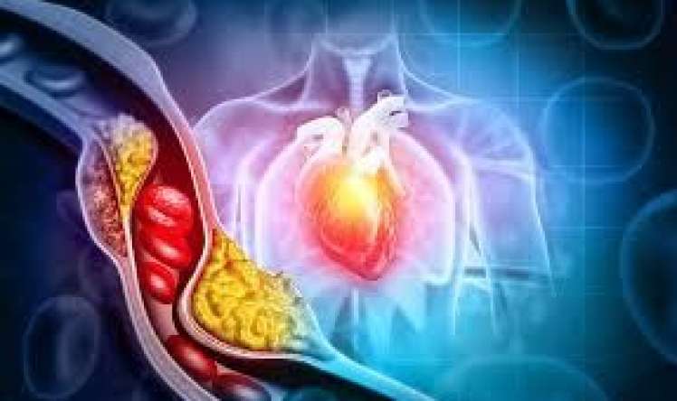   Qəfil ürək ölümü riski yüksək  insanlar   kimlərdir?