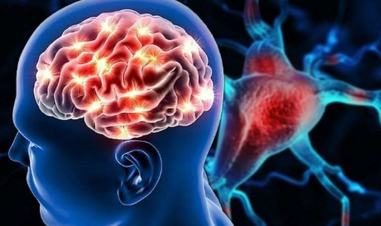  Meteohəssaslığa yozmayın  – Bu əlamət insultdan öncə ola bilər