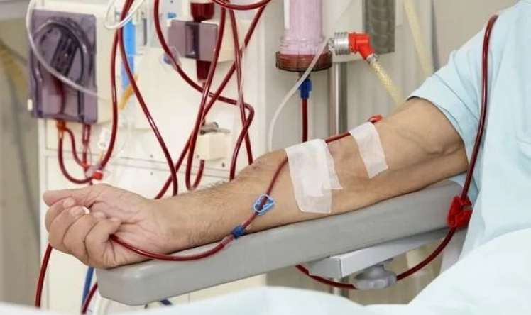Yeni hemodializ şöbələri yaradılacaq 