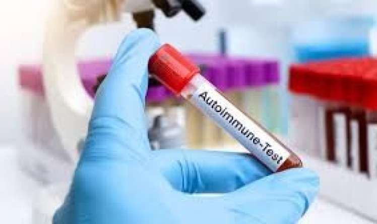 Azərbaycanın ilk autoimmun laboratoriyası  hardadır? 