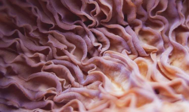 Təhlükəli göbələklərin SİYAHISI  – ÜST