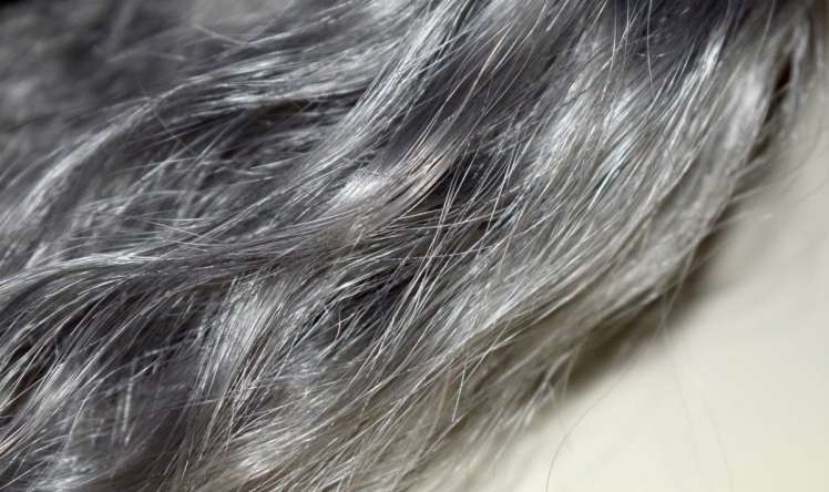  Vaxtından əvvəl saçların ağarması  – Bərpa etmək olarmı?