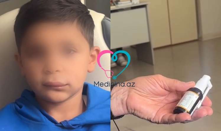 Boğaz spreyindən sonra uşağın üzü  dəhşətli hala düşdü - VİDEO