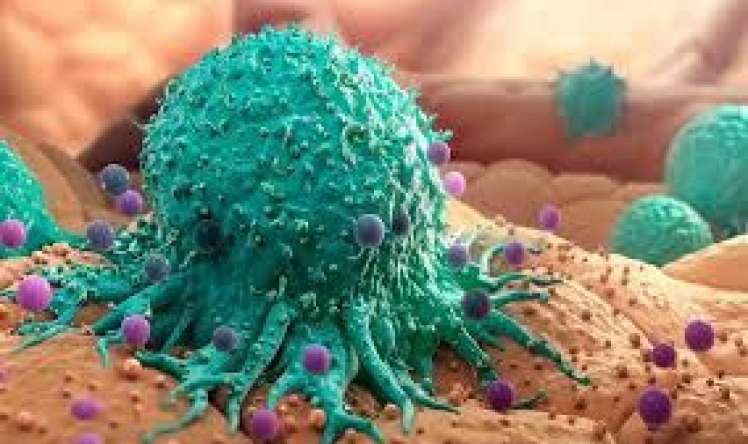 Onkologiyanın müalicəsində effektiv ikili 