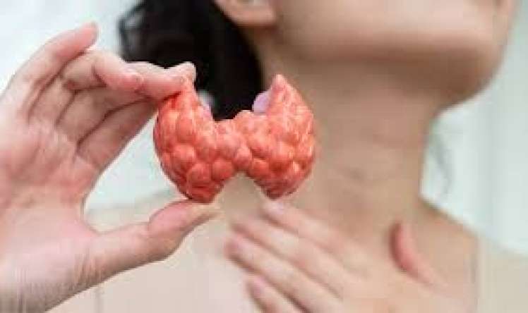 Dırnaqlarda qalxanvari vəz xəstəliyinin əlaməti 