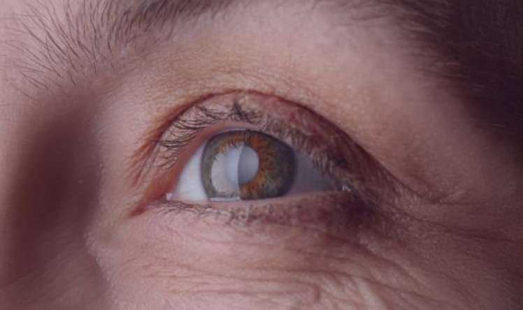 Gözlə beyin arasında əlaqənin pozulduğu xəstəlik 