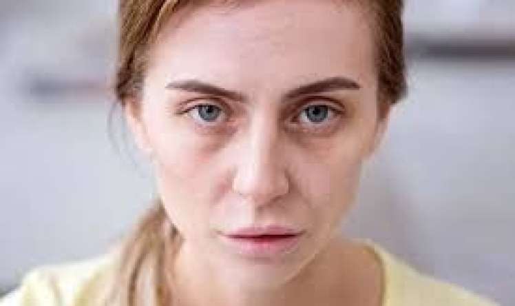 Bir baxışla qanazlığı diaqnozu qoymaq olmaz 