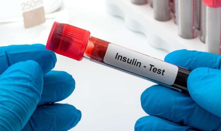 Ürək xəstəliklərinin əsas səbəbi insulin dirəncidir -  Kardioloqdan VİDEO