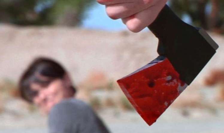 Əmisi tərəfindən baltalanan azyaşlının vəziyyəti açıqlandı 