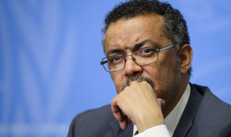 ÜST yüzlərlə işçini ixtisar edir 