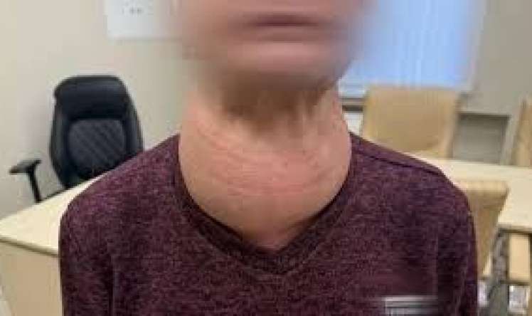 Qadının zobu baş ölçüsünə çatdı 