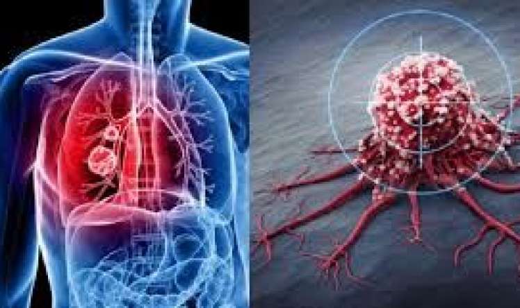 Xərçəngin inkişafına təsir edən     gizli amil