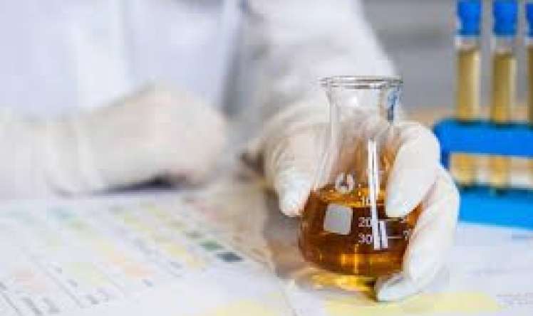 Sidiyin  rənginə  bax   - xəstəliyini tap