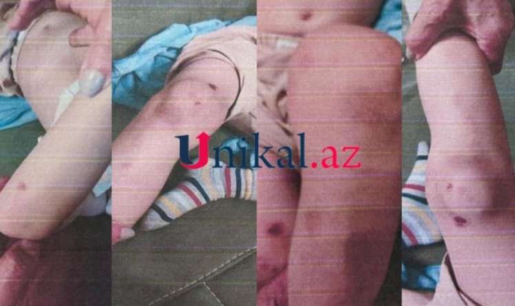 Sevgilisi ilə birlikdə 6 yaşlı oğluna işgəncə edən anaya    - hökm oxundu