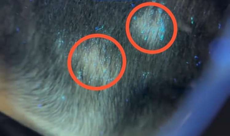 Küçə pişiyi ilə oynayan uşağın saçı töküldü -  Dəri göbələyi yarandı-VİDEO