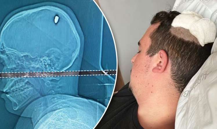 1 sutka başında güllə ilə gəzən kişi    - əməliyyat olundu