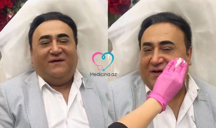 Elgiz üzünə estetik prosedurlar etdirdi -  VİDEO