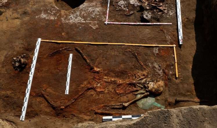 Skif qadın 2500 il əvvəl unikal    əməliyyat keçirib