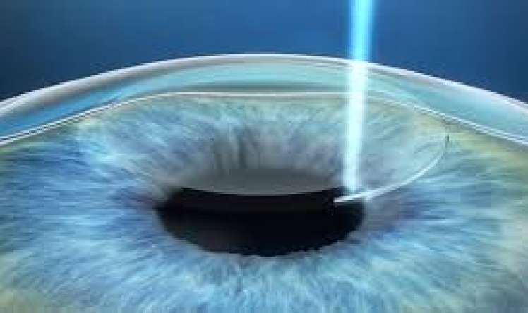 Bu nevroloji xəstəliyin ilk əlaməti    gözlərdən başlayır