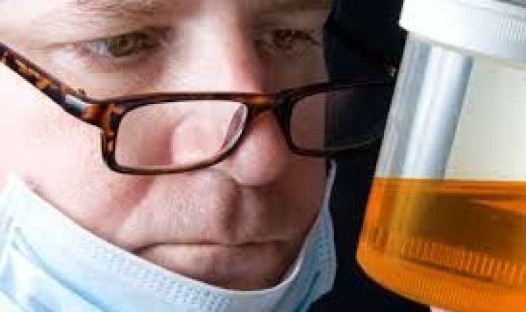 Mədəaltı vəz xərçənginin sidikdə görünən   əlaməti