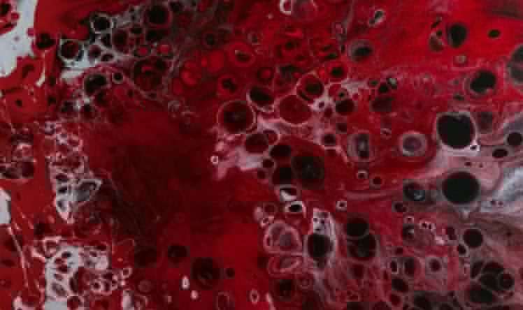 Qanımızın  çox  yağlı olub –olmamasını  necə bilək? 