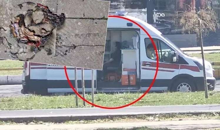 Helium şarlar bomba kimi partladı -  2 uşaq yaralandı-FOTO