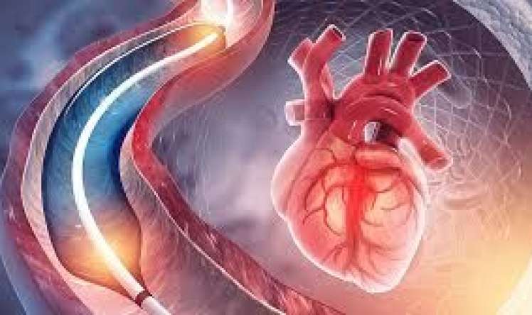Ürək damarlarının tutulduğunu göstərən    8 əsas əlamət