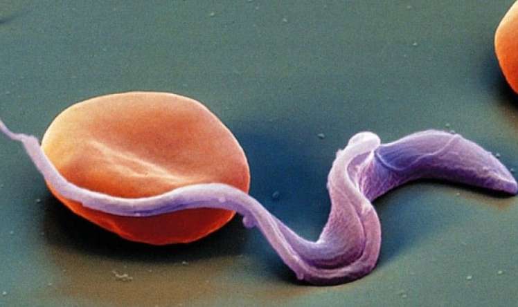  Pişik paraziti şizofreniyaya səbəb ola bilər 