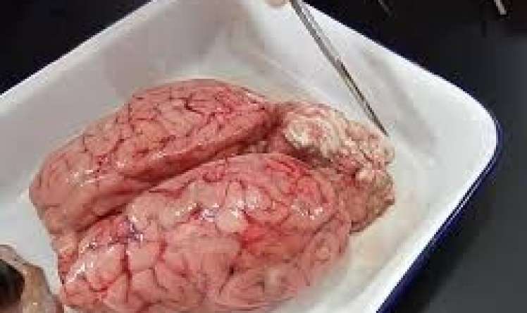 Beyində qurd və parazitlər  - Əlamətlər