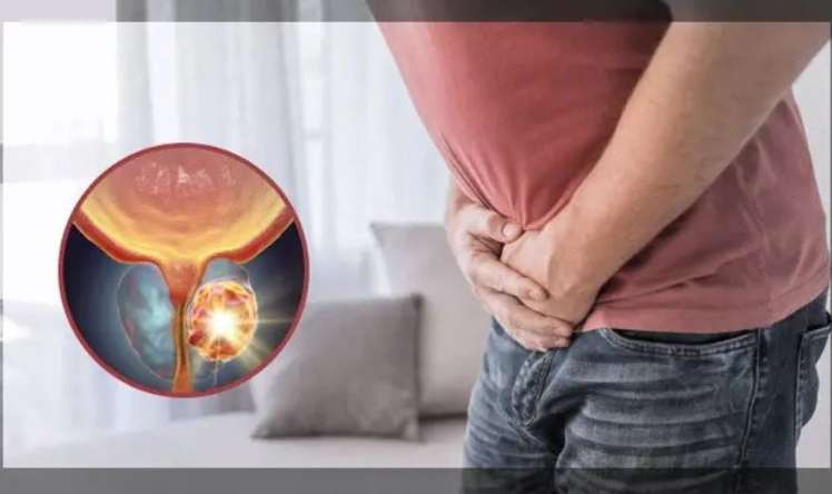 Xərçəng kişilərdə  sonsuzluğa səbəb ola bilərmi?