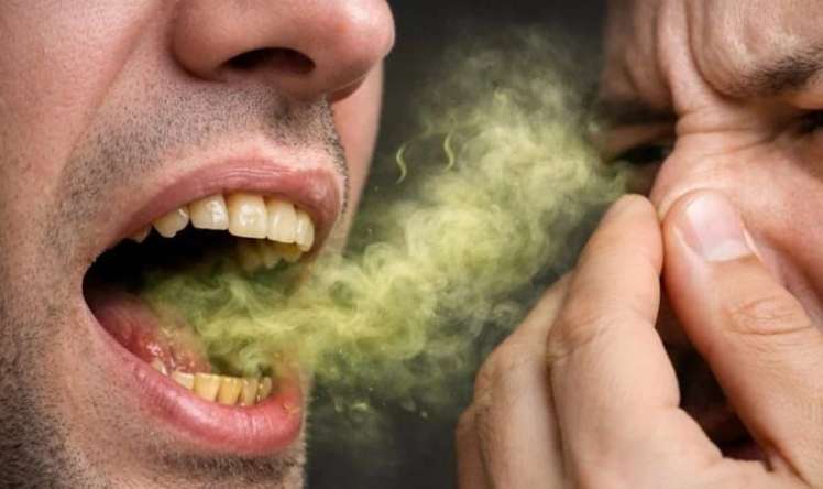 Ağız qoxusunun  6 əsas səbəbi