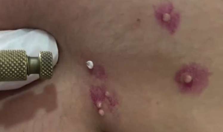 İdman zalından keçən yoluxucu virus- VİDEO