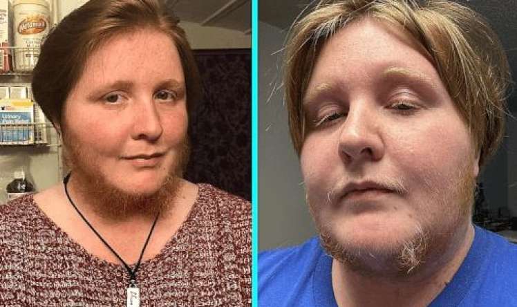 Saqqallı qadın özünü hamıdan gözəl    hesab edir